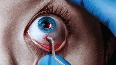 Virus