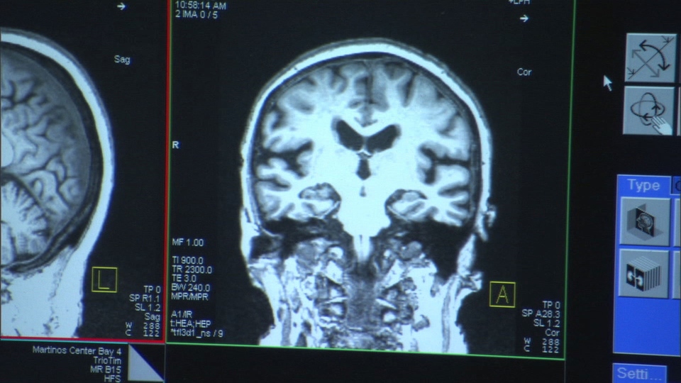 Documentary The Alzheimer's Project